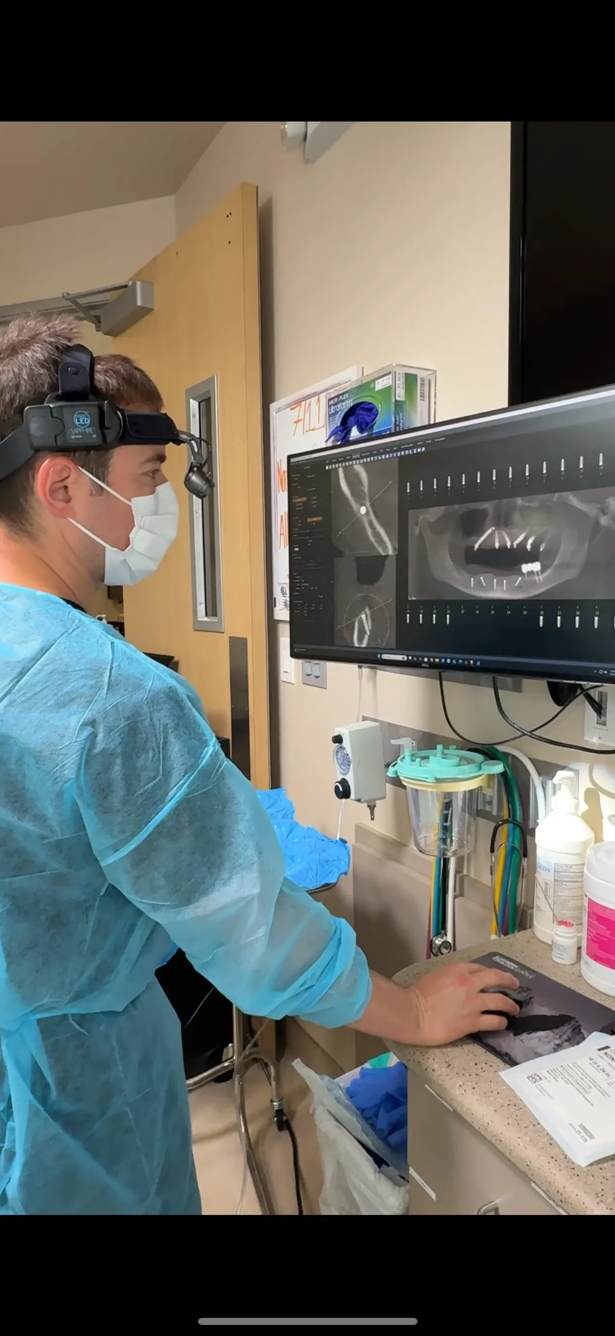 Dental Implant Planning with 3D Imaging Technology