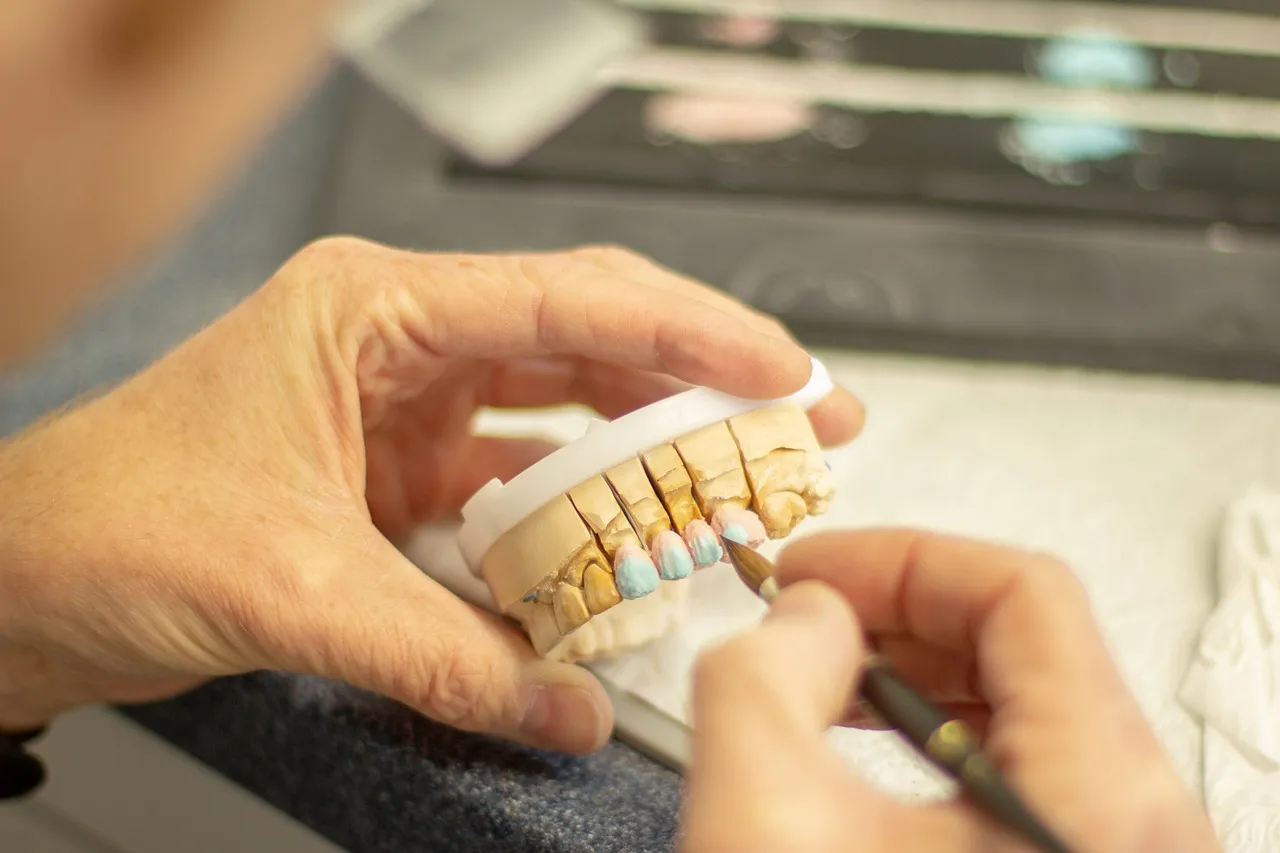 Dental Implant Failure Symptoms Guide