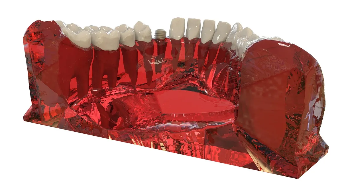 Mini Dental Implants: Are They Right for You?