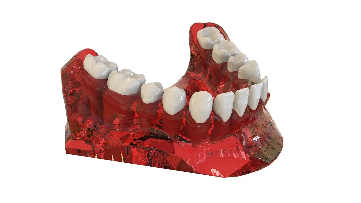 Single Tooth Implant Roseville: 2026 Patient Guide