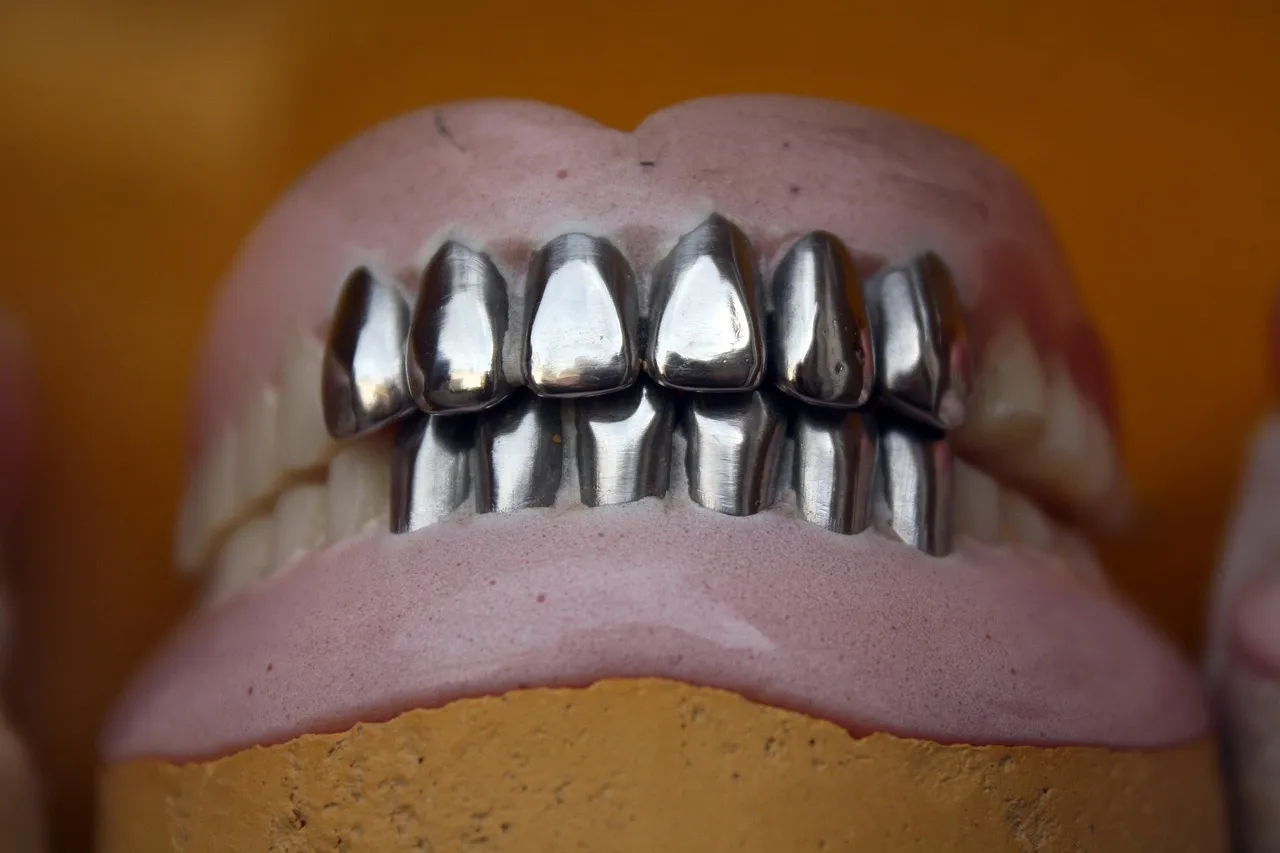 Single Tooth Implants: The Permanent Solution