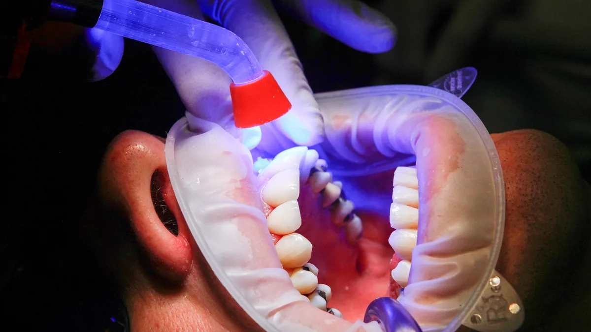 What Is Dry Socket? Causes, Symptoms & Treatment Guide