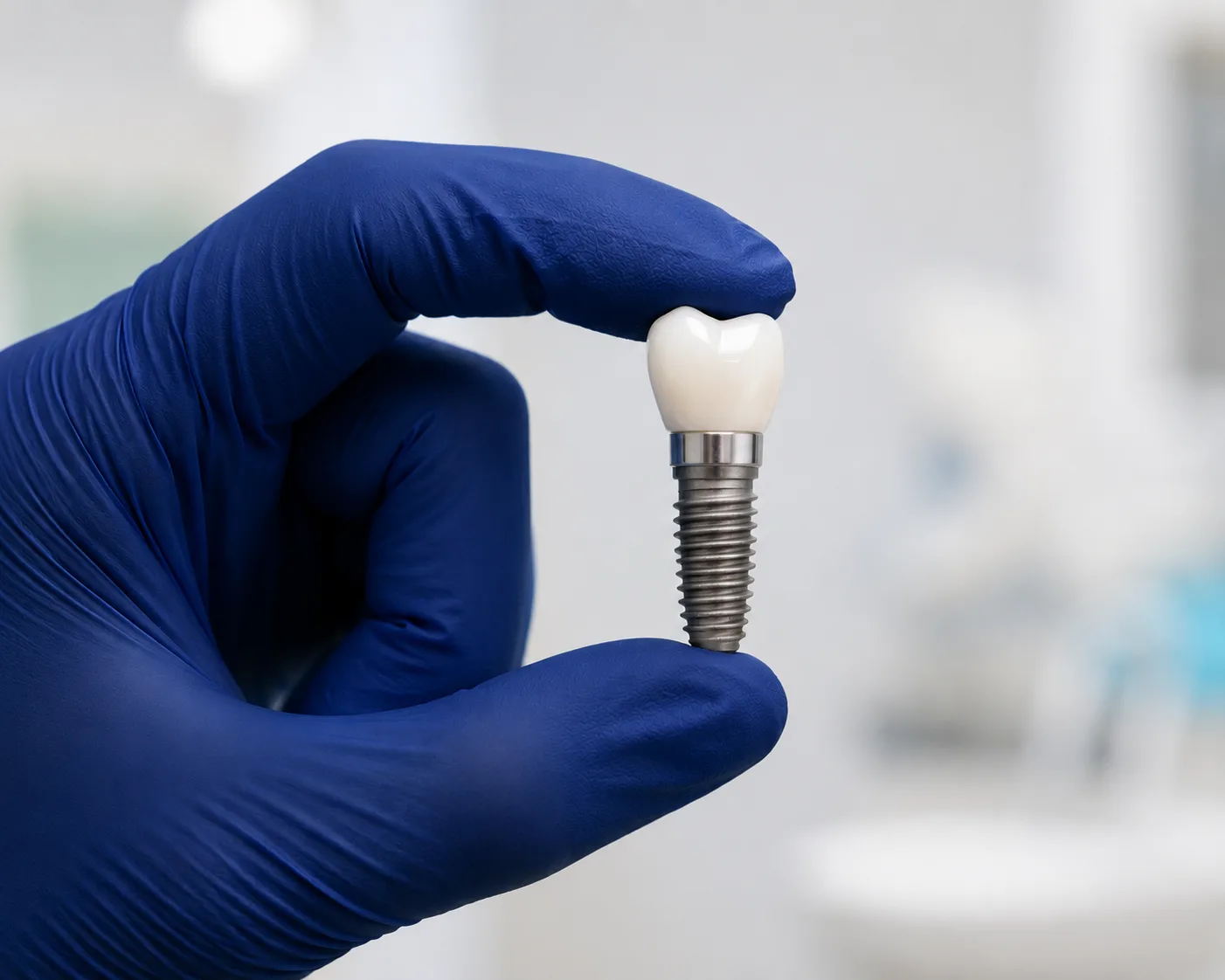 The Real Cost of Waiting to Get Dental Implants: How Delay Can Turn a Simple Case Into a Complex One