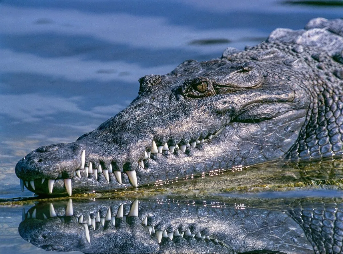 Confident smile after dental implant treatment