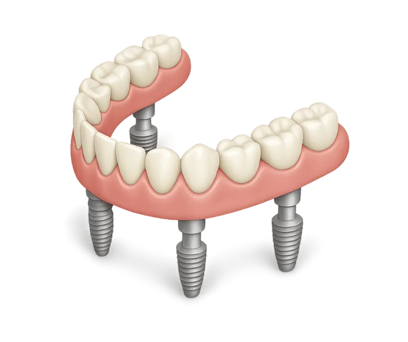 Final Teeth Options