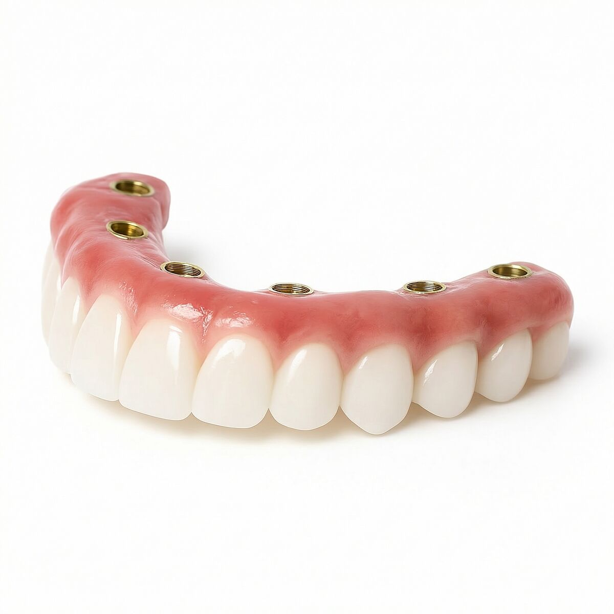 Premium zirconia arch prosthesis crafted at Fusion Dental Implants